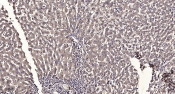 Cathepsin D rabbit pAb Antibody