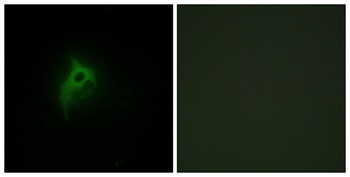 AR α2B rabbit pAb Antibody