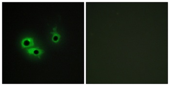 AGR3 rabbit pAb Antibody
