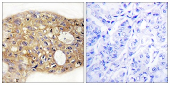 AGR3 rabbit pAb Antibody