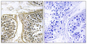 CYP2C8 rabbit pAb Antibody