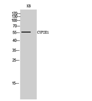 CYP2E1 rabbit pAb Antibody