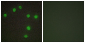 Nkx-6.3 rabbit pAb Antibody