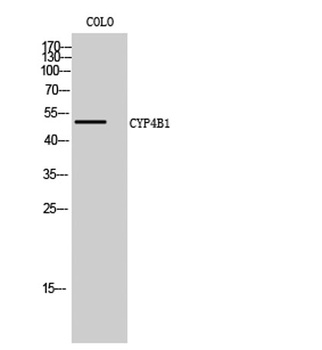 CYP4B1 rabbit pAb Antibody