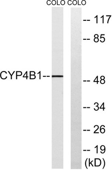 CYP4B1 rabbit pAb Antibody