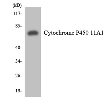 CYP11A1 rabbit pAb Antibody