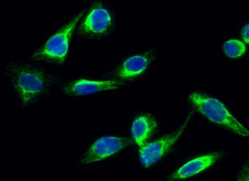 CYP17A1 rabbit pAb Antibody
