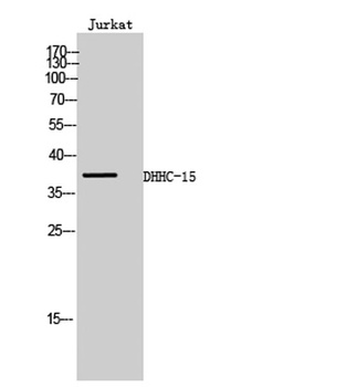 DHHC-15 rabbit pAb Antibody
