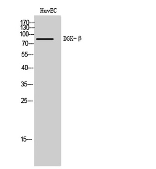 DGK-β rabbit pAb Antibody