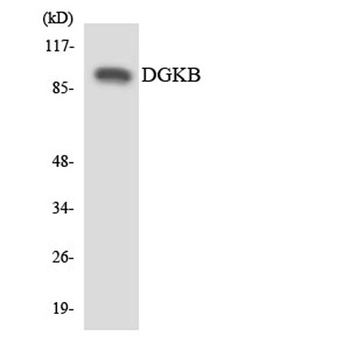 DGK-β rabbit pAb Antibody