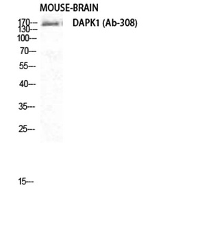 DAPK1 rabbit pAb Antibody