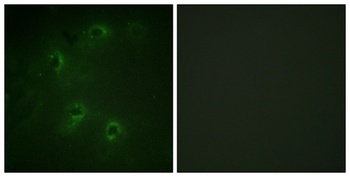 DAPK1 rabbit pAb Antibody