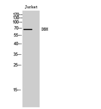 DBH rabbit pAb Antibody