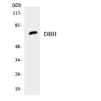 DBH rabbit pAb Antibody