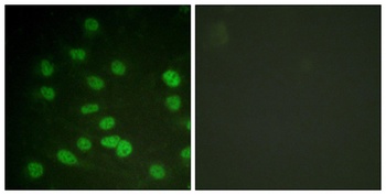 DDX3 (phospho Thr322) rabbit pAb