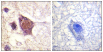 DDX3 (phospho Thr322) rabbit pAb