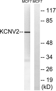 KV8.2 rabbit pAb Antibody