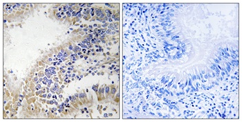 DHODH rabbit pAb Antibody