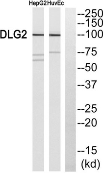 PSD-93 rabbit pAb Antibody