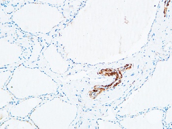 TdT rabbit pAb Antibody