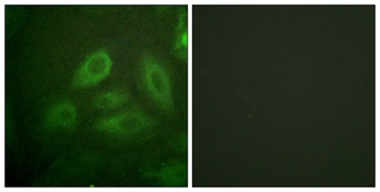 CRMP-2 (phospho Thr514) rabbit pAb