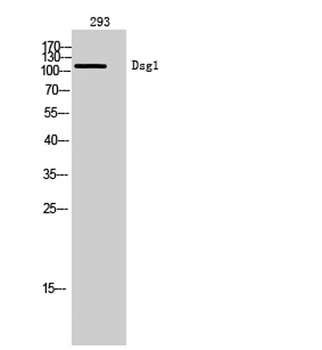 Dsg1 rabbit pAb Antibody