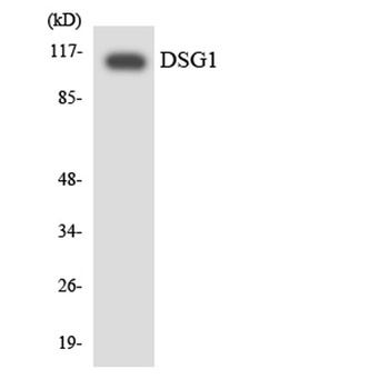 Dsg1 rabbit pAb Antibody