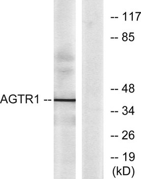 AT1 rabbit pAb Antibody