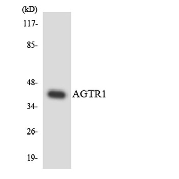 AT1 rabbit pAb Antibody