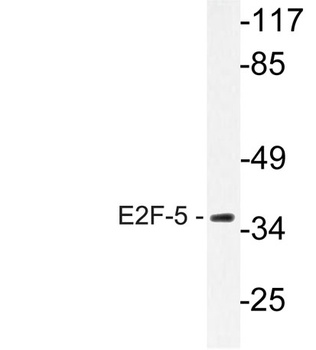 E2F-5 rabbit pAb Antibody
