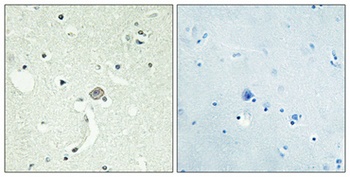 EDG-1 rabbit pAb Antibody