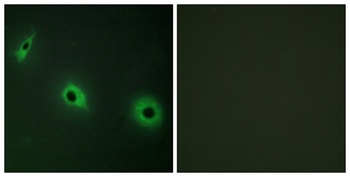 CDHF11 rabbit pAb Antibody