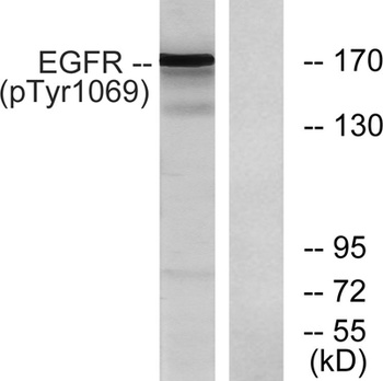EGFR (phospho Tyr1069) rabbit pAb Antibody