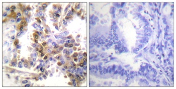 4E-BP1 rabbit pAb Antibody