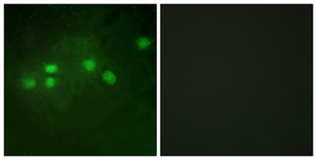 Elf-1 rabbit pAb Antibody
