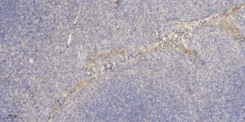 Macroglobulin α-2 rabbit pAb Antibody