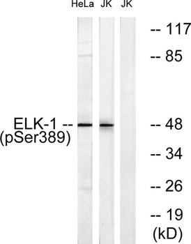 Elk-1 (phospho Ser389) rabbit pAb Antibody