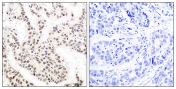 Elk-1 (phospho Thr417) rabbit pAb Antibody