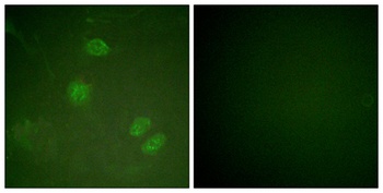 Net rabbit pAb Antibody