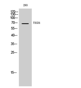 TIGD1 rabbit pAb Antibody