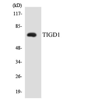 TIGD1 rabbit pAb Antibody