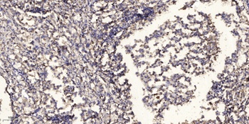 TIGD1 rabbit pAb Antibody