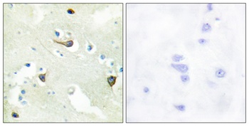 EphB1/2/3 rabbit pAb Antibody