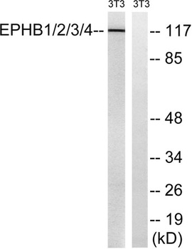 EphB1/2/3/4 rabbit pAb Antibody