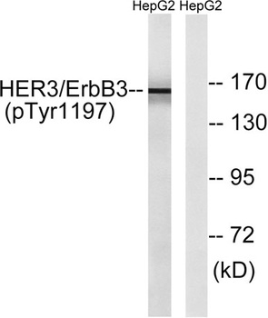 ErbB-3 (phospho Tyr1197) rabbit pAb Antibody