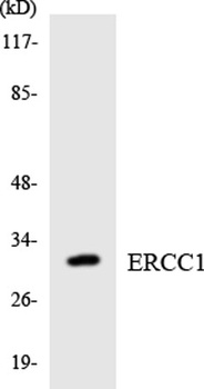 ERCC1 rabbit pAb Antibody