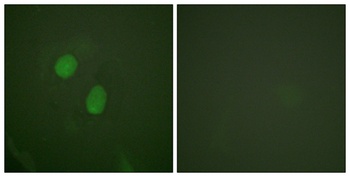 ERα (phospho Ser305) rabbit pAb Antibody