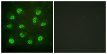 ERβ (phospho Ser105) rabbit pAb