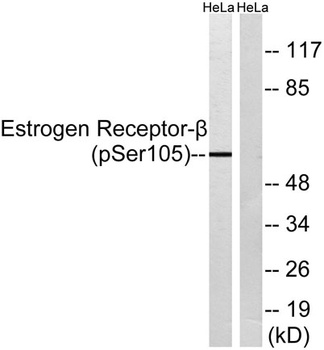 ERβ (phospho Ser105) rabbit pAb