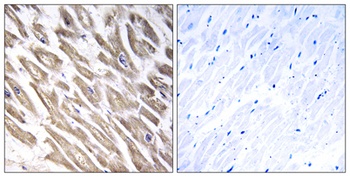 Factor XIII B rabbit pAb Antibody